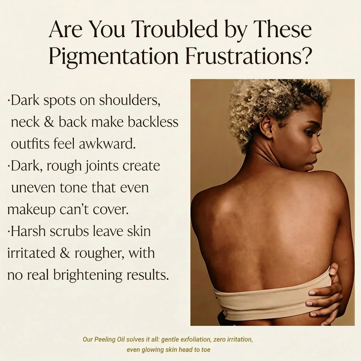 Aussie Betta Extra Strong Peeling Oil — Are You Troubled by These Pigmentation Frustrations? Dark spots on shoulders, rough joints, harsh scrubs that don't work